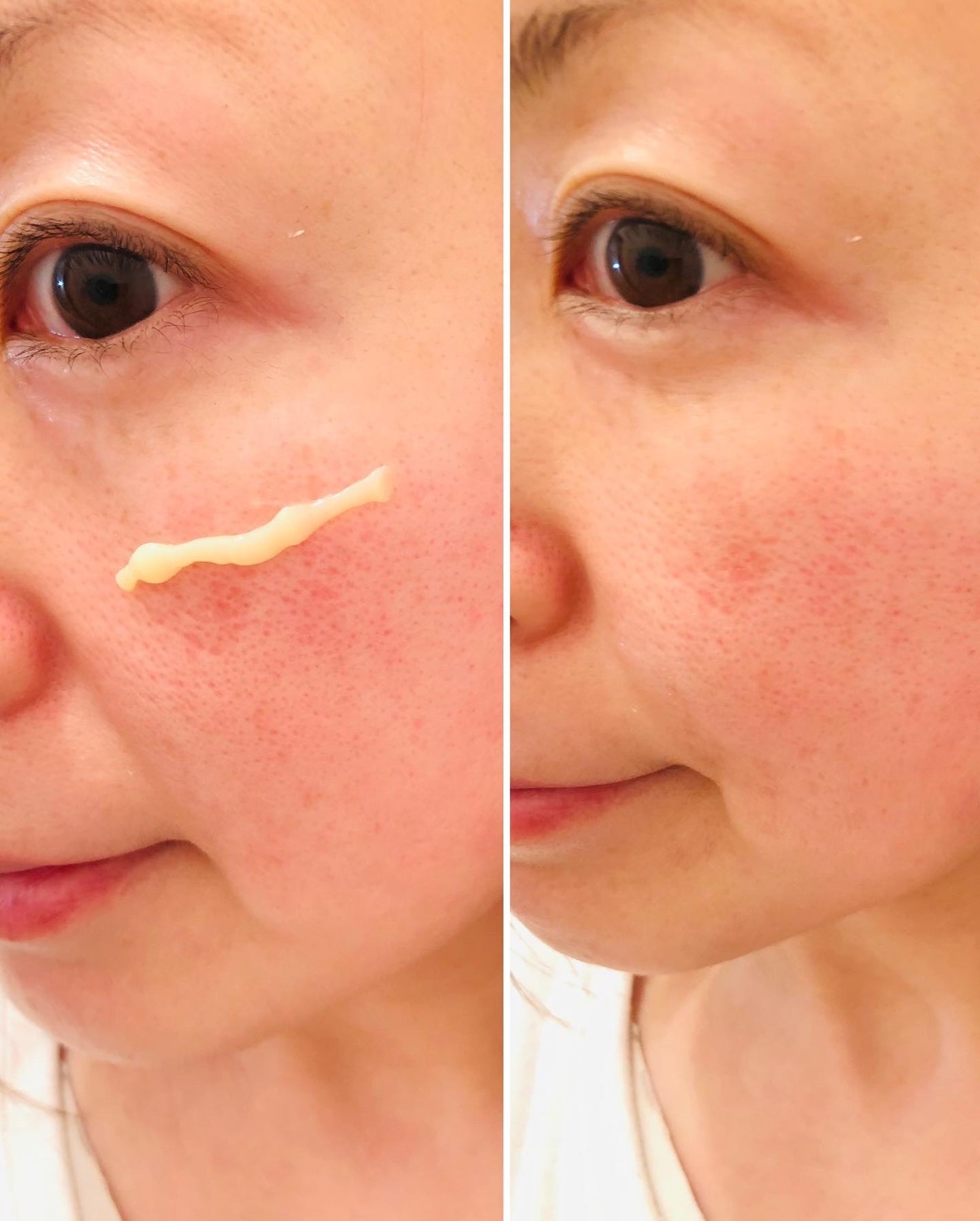 VITALIFT A forte/Dr.Different/フェイスクリームを使ったクチコミ(8枚目)