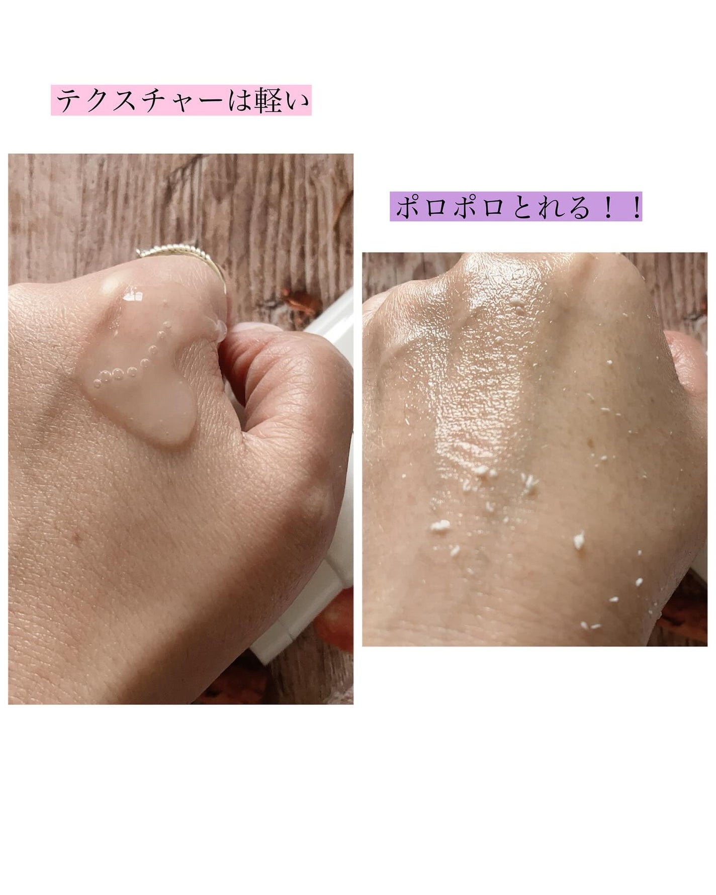 NIKIPITA 薬用GG角質クリアケアジェル/NIKI PITA/ピーリングを使ったクチコミ(2枚目)