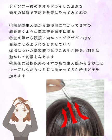 アロマ リヴァイタ アドバンスト スキャルプトリートメント/ラ・カスタ/頭皮ケアを使ったクチコミ(5枚目)