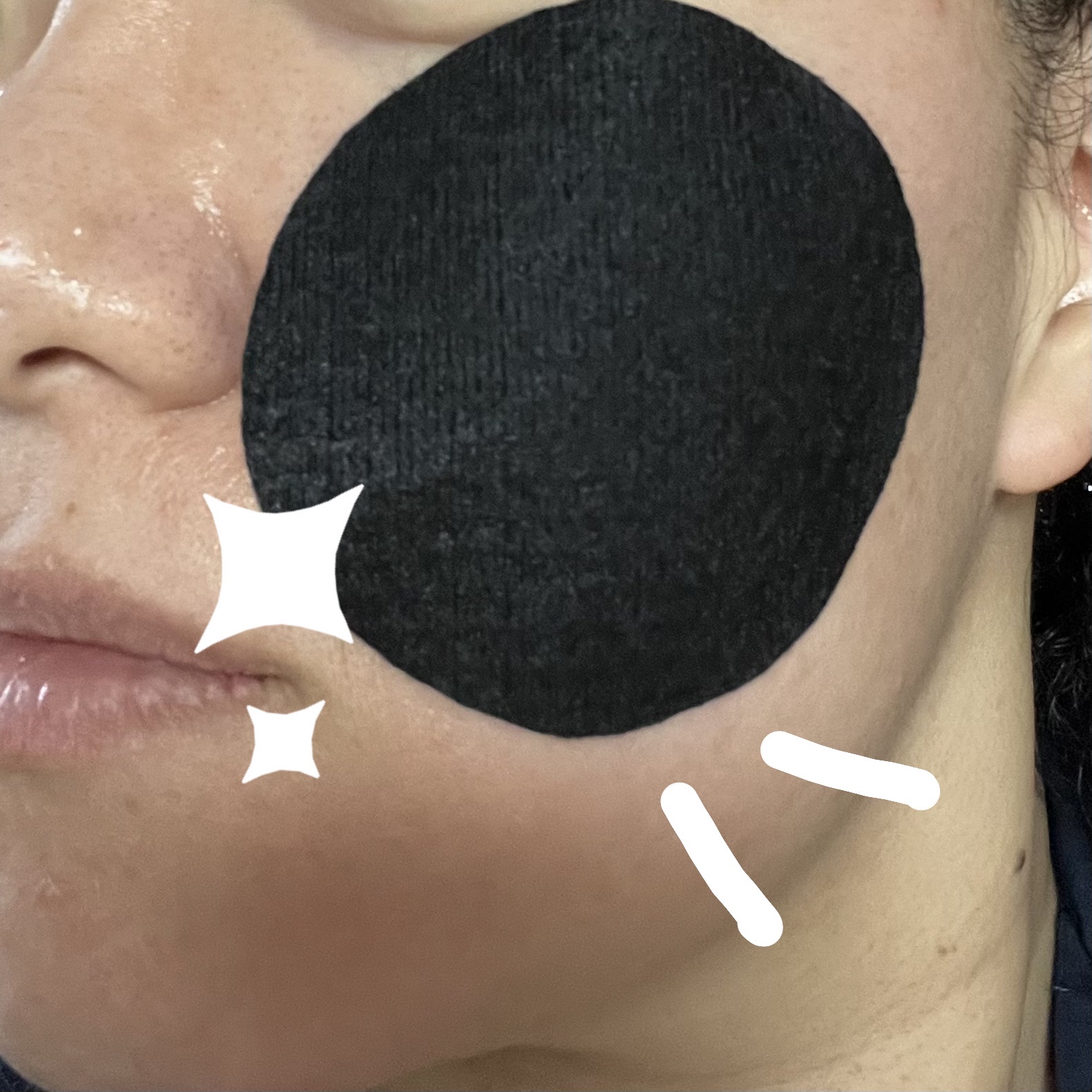 Dermatory Pore Clear Black Padのクチコミ「Dematoryさんの黒いトナーパッド🖤
パッドが黒いってだけで、気になって…「欲しい！使って.....」（2枚目）