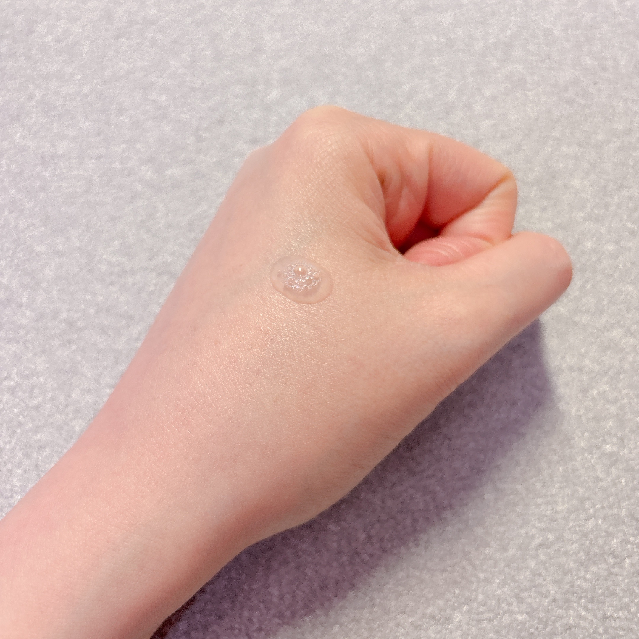 ミノン アミノモイスト 薬用アクネケア ローション/ミノン/化粧水を使ったクチコミ（2枚目）