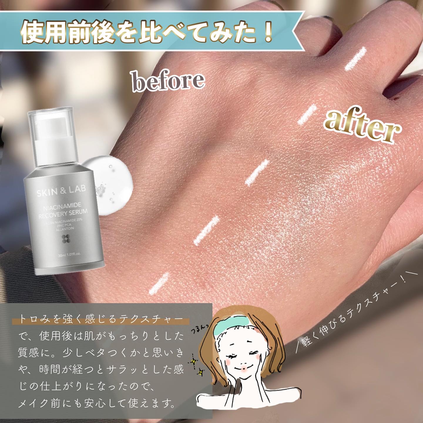 ヴィーガンリポソームレチノールセラム/SKIN&LAB/美容液を使ったクチコミ（3枚目）