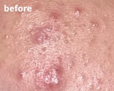 メイク落としジェル/オードムーゲ/クレンジングジェルを使ったクチコミ（2枚目）