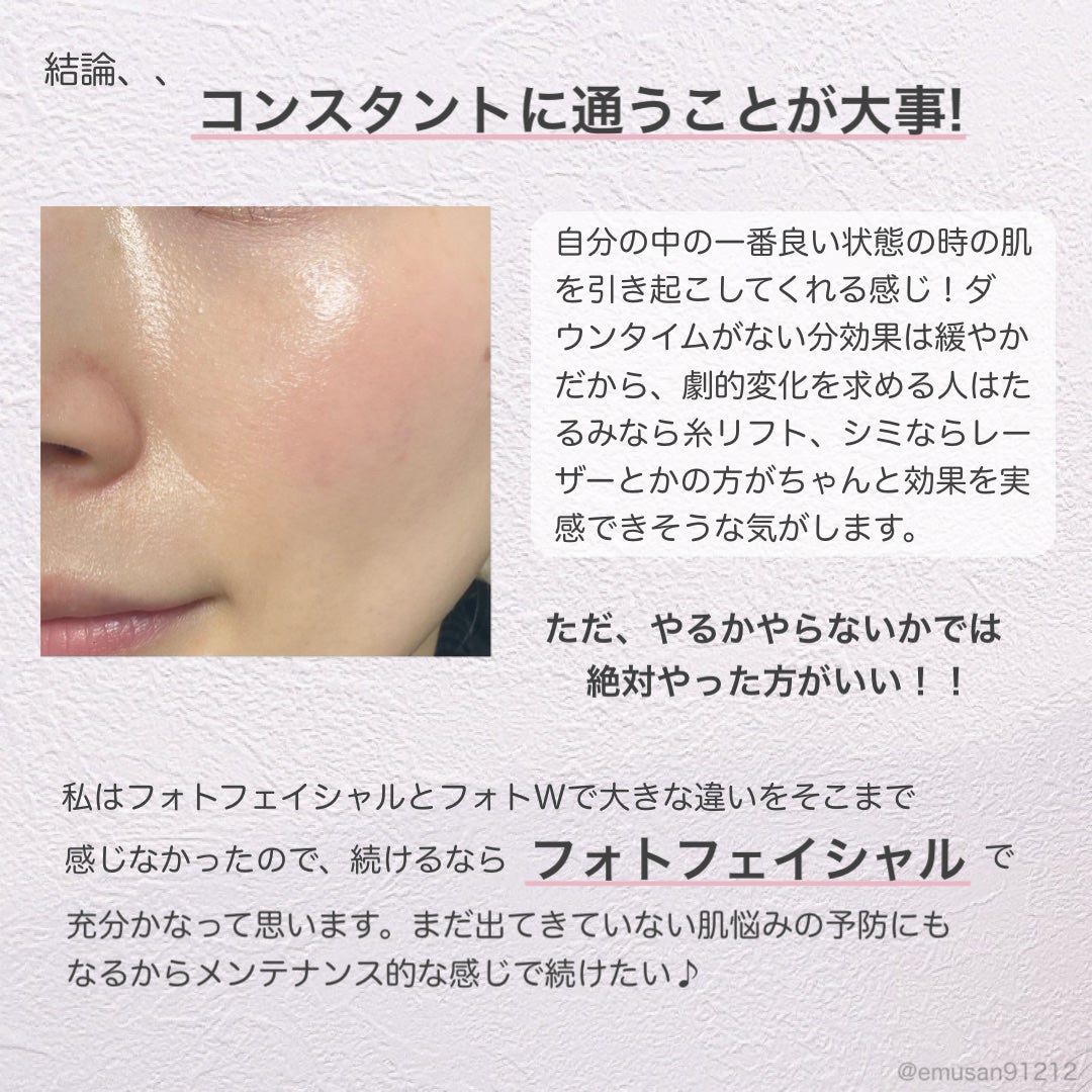 *えむさん🐑* on LIPS 「【美容施術レポ👀💕フォトフェイシャル&フォトダブルを終えてみて..」(6枚目)