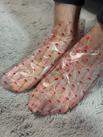 ベビーフット 重曹殺菌消毒洗浄剤/ベビーフット/レッグ・フットケアを使ったクチコミ(2枚目)