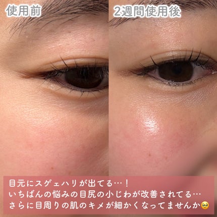 カプチュール トータル ヒアルショット|Diorの口コミ - 1月12日 カプチュール トータル ヒアルショット|Diorの口コミ - 1月12日