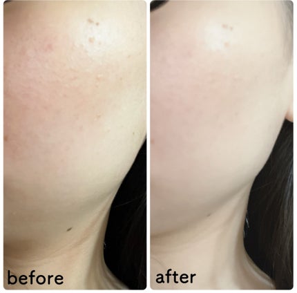 クリーンティーツリーリポソームトーンアップサンクリーム(グリーン)/ダルバ/日焼け止めクリームを使ったクチコミ(5枚目)