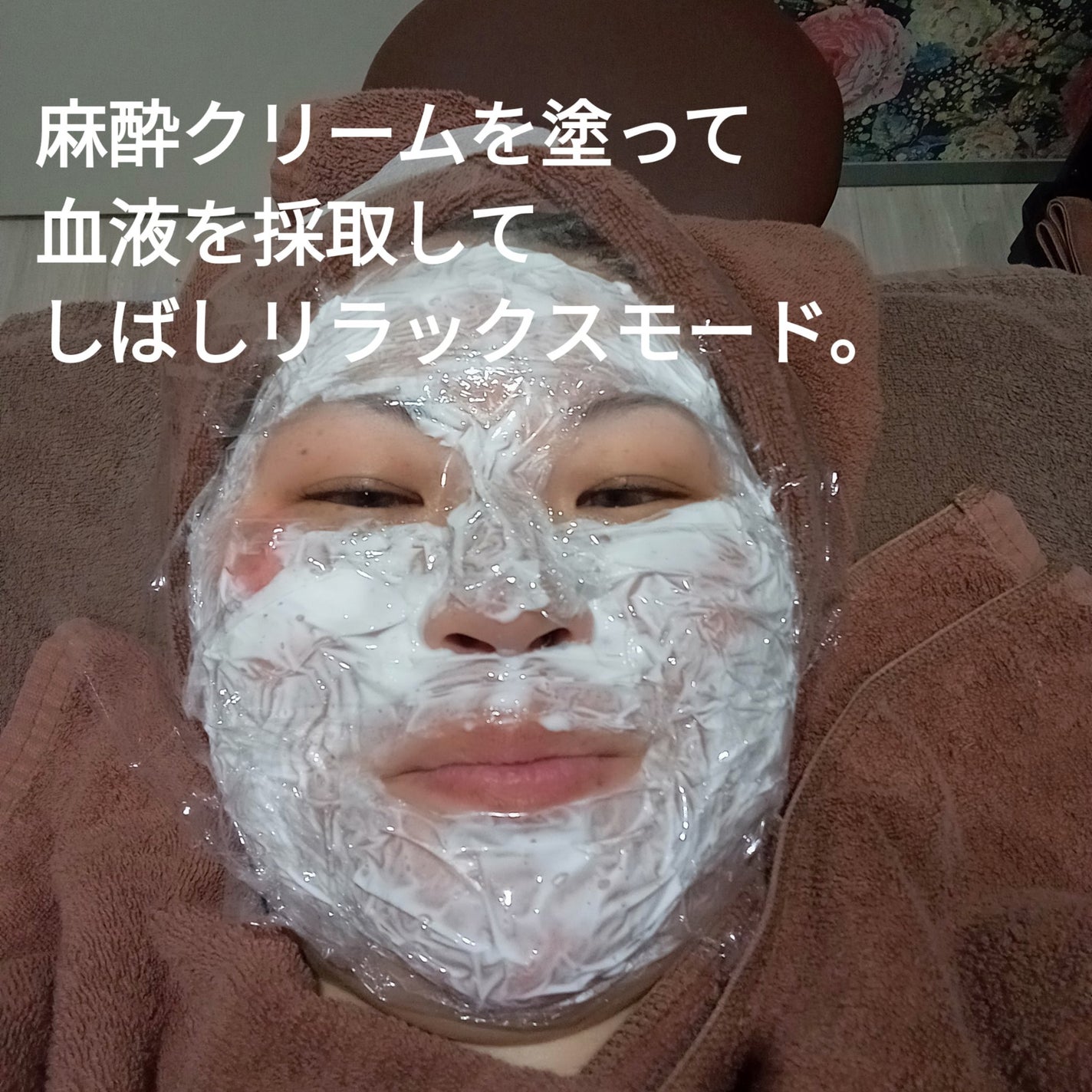 ビヨンセ奥二重向上委員長🥸LIPSパートナー🥳 on LIPS 「⚠️速報⚠️セシリアクリニック横浜院さんでヴァンパイアフェイシ..」(6枚目)