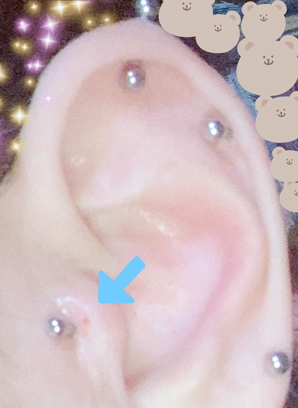 瞬間ピアッサー Q66/ヒーロー /その他を使ったクチコミ（2枚目）