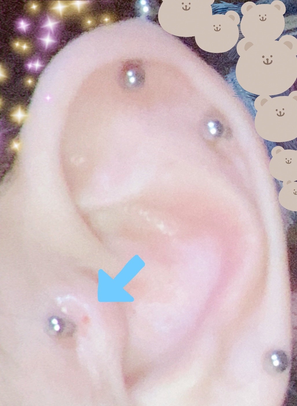 瞬間ピアッサー Q66/ヒーロー /その他を使ったクチコミ(2枚目)