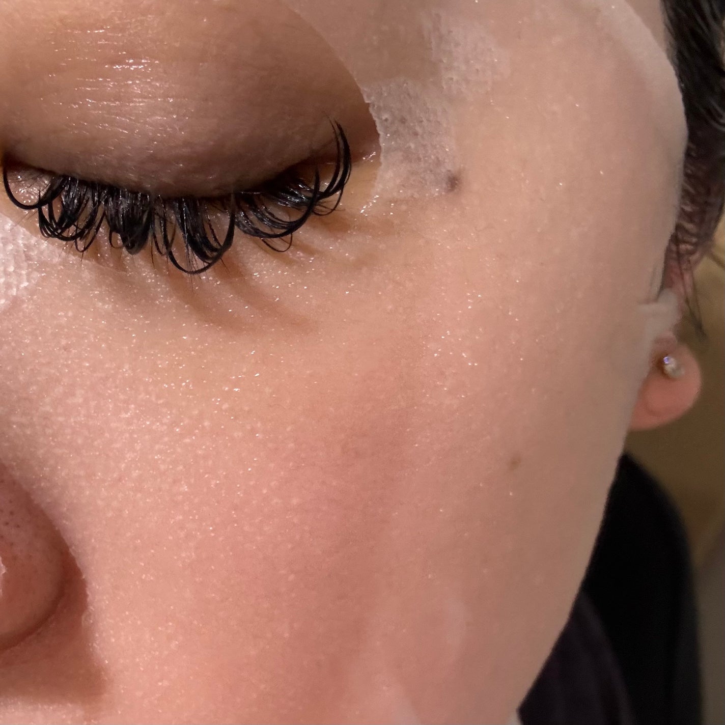 ダーマレーザースーパーVC100マスク/クオリティファースト/シートマスク・パックを使ったクチコミ(3枚目)