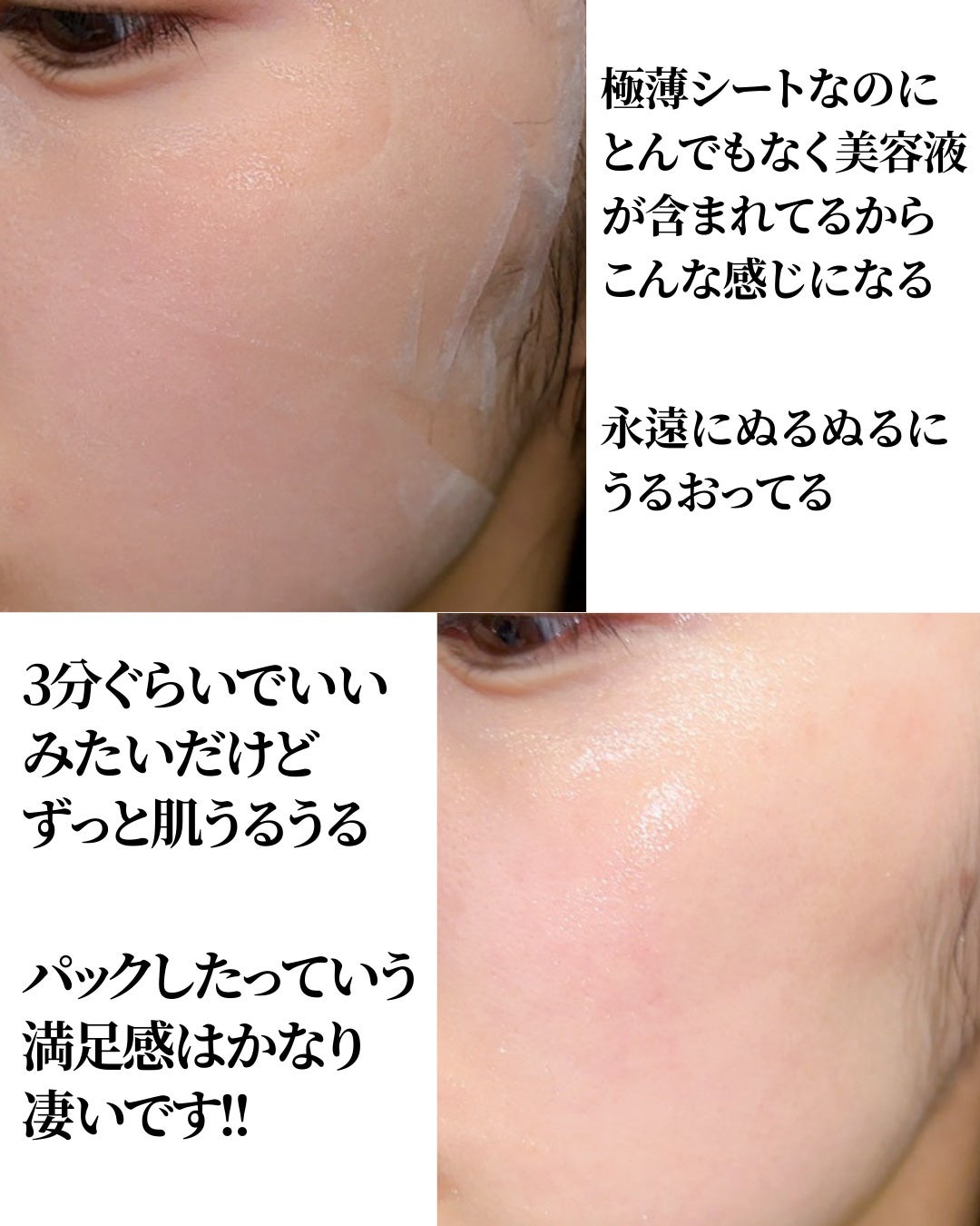 濃密ハイドロマスク/CEZANNE/シートマスク・パックを使ったクチコミ(7枚目)