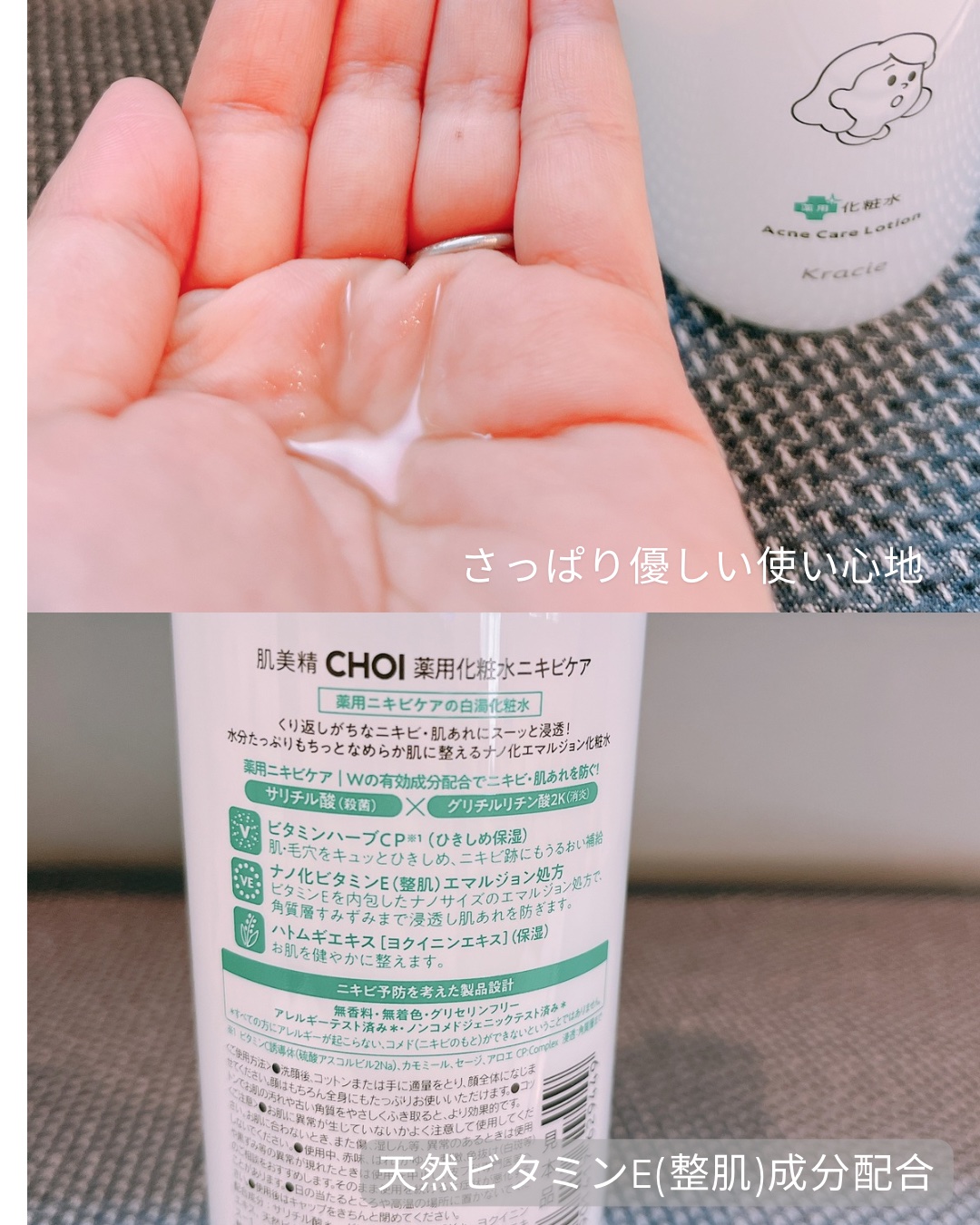 肌美精 CHOI薬用化粧水 ニキビケア[医薬部外品]/肌美精/化粧水を使ったクチコミ（2枚目）