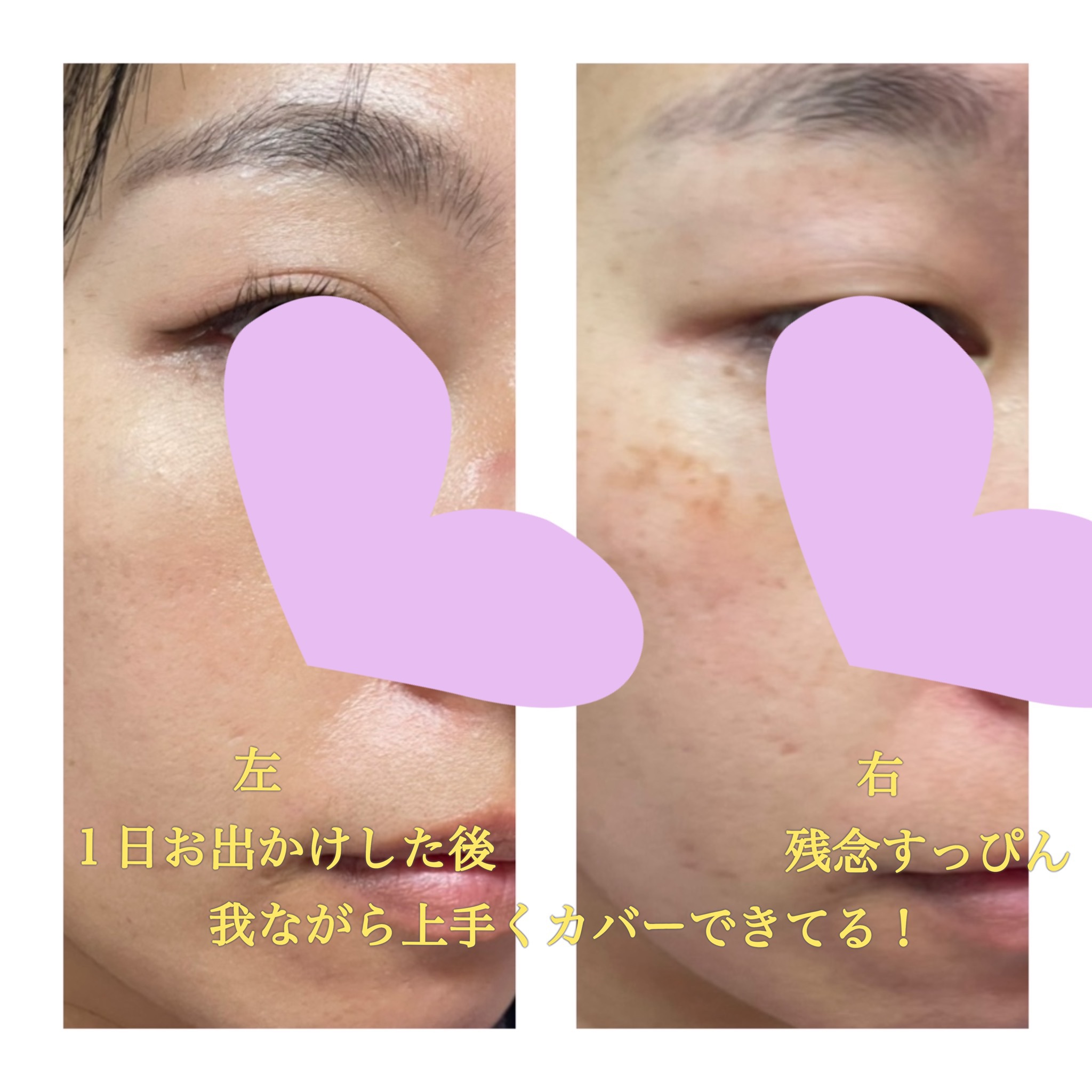 フローレス フィット FN30/COVERMARK/クリーム・エマルジョンファンデーションを使ったクチコミ（1枚目）