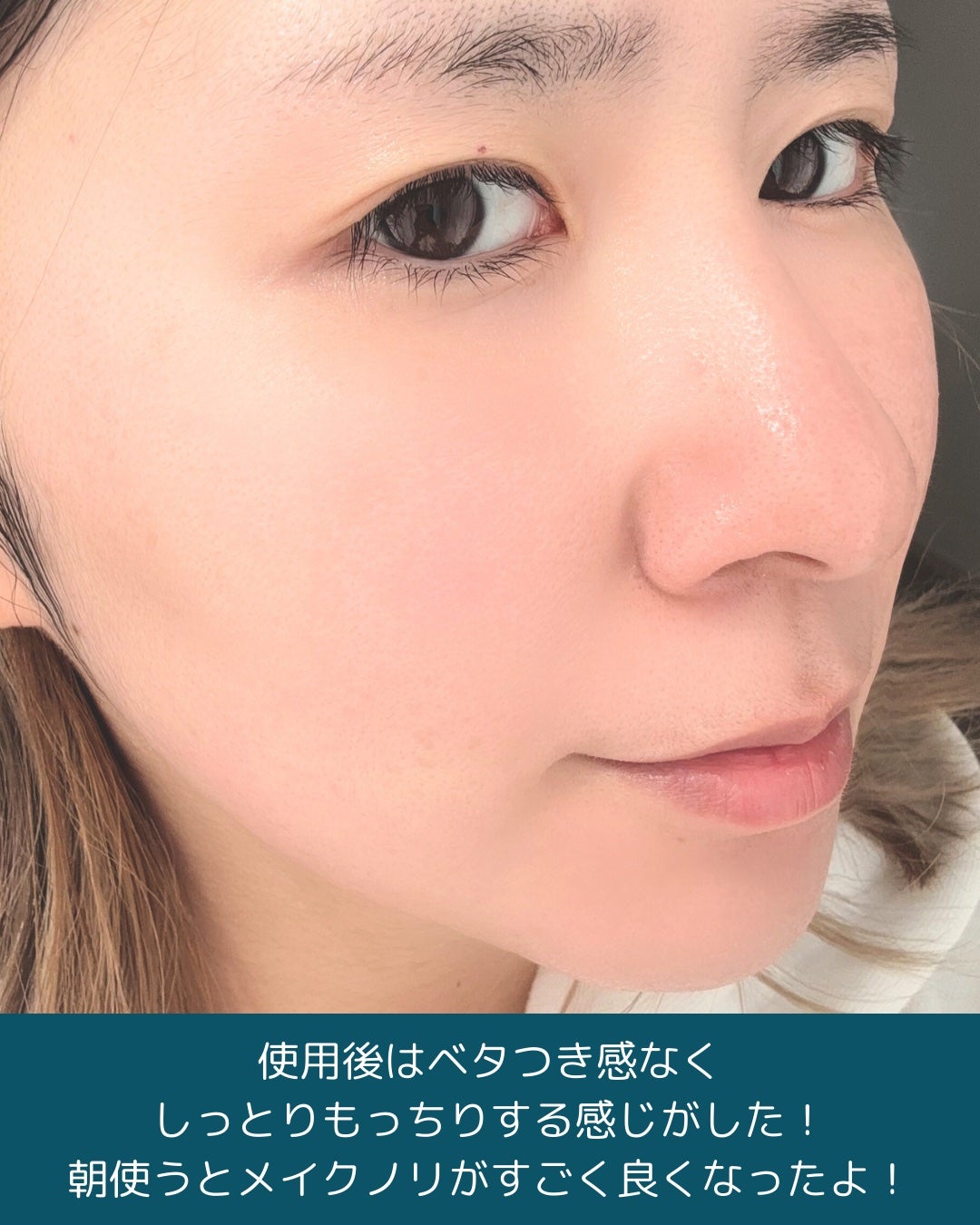 ルルルン ハイドラ AZ マスク/ルルルン/シートマスク・パックを使ったクチコミ(4枚目)