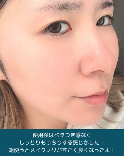 ルルルン ハイドラ AZ マスク/ルルルン/シートマスク・パックを使ったクチコミ(4枚目)