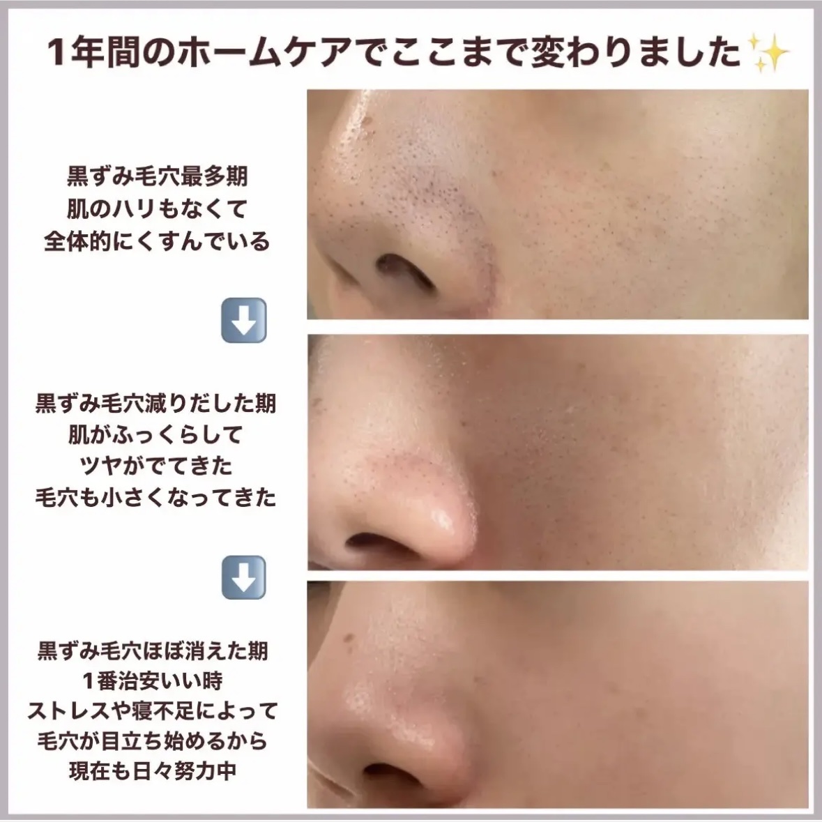 潤浸保湿 化粧水 III とてもしっとり/キュレル/化粧水を使ったクチコミ（2枚目）