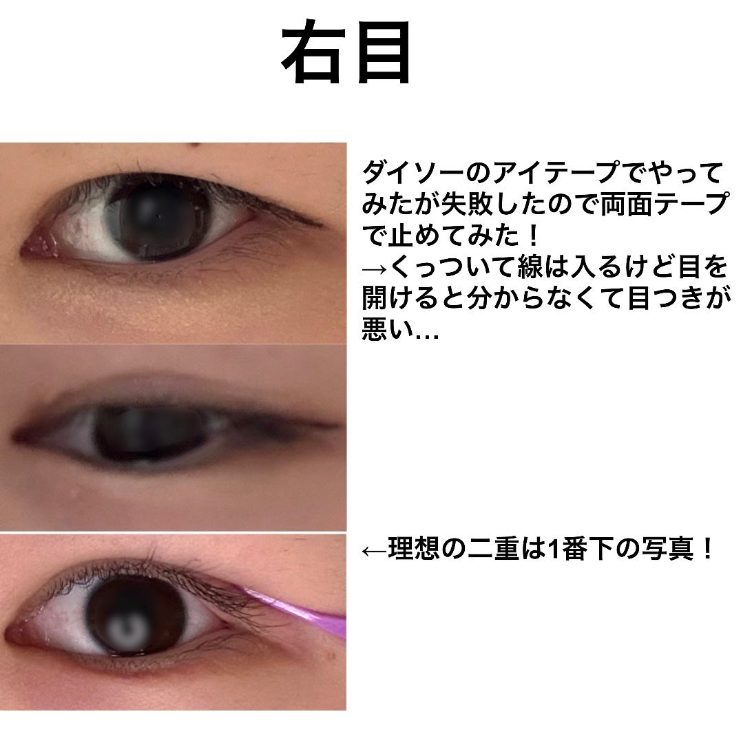Karin on LIPS 「Karinの二重日記📓♡D-3だいぶ左目が自然に跡がつくように..」(4枚目)