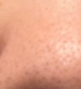 デュオ ザ クレンジングバーム ブラックリペア/DUO/クレンジングバームを使ったクチコミ(4枚目)