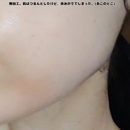 オーガニック ハトムギエキス (ヨクイニン)/KISO/その他を使ったクチコミ(5枚目)