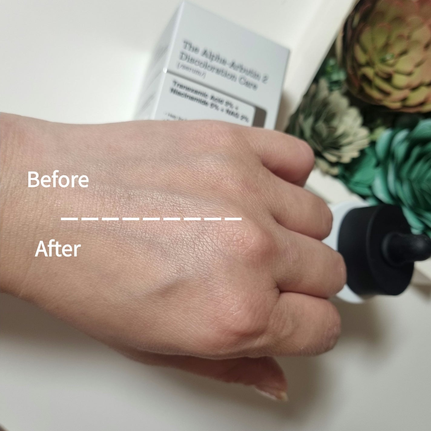 RXザ・アルファアルブチン2 ニキビ跡ケアセラム/COSRX/美容液を使ったクチコミ(4枚目)