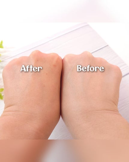 プロバイオシカ インテンシブ アンプル/SKIN1004/美容液を使ったクチコミ(6枚目)