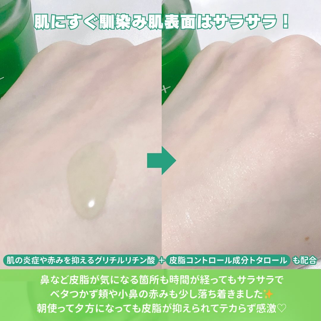 アゼライン酸15 インテンスカーミングセラム/Anua/美容液を使ったクチコミ（3枚目）