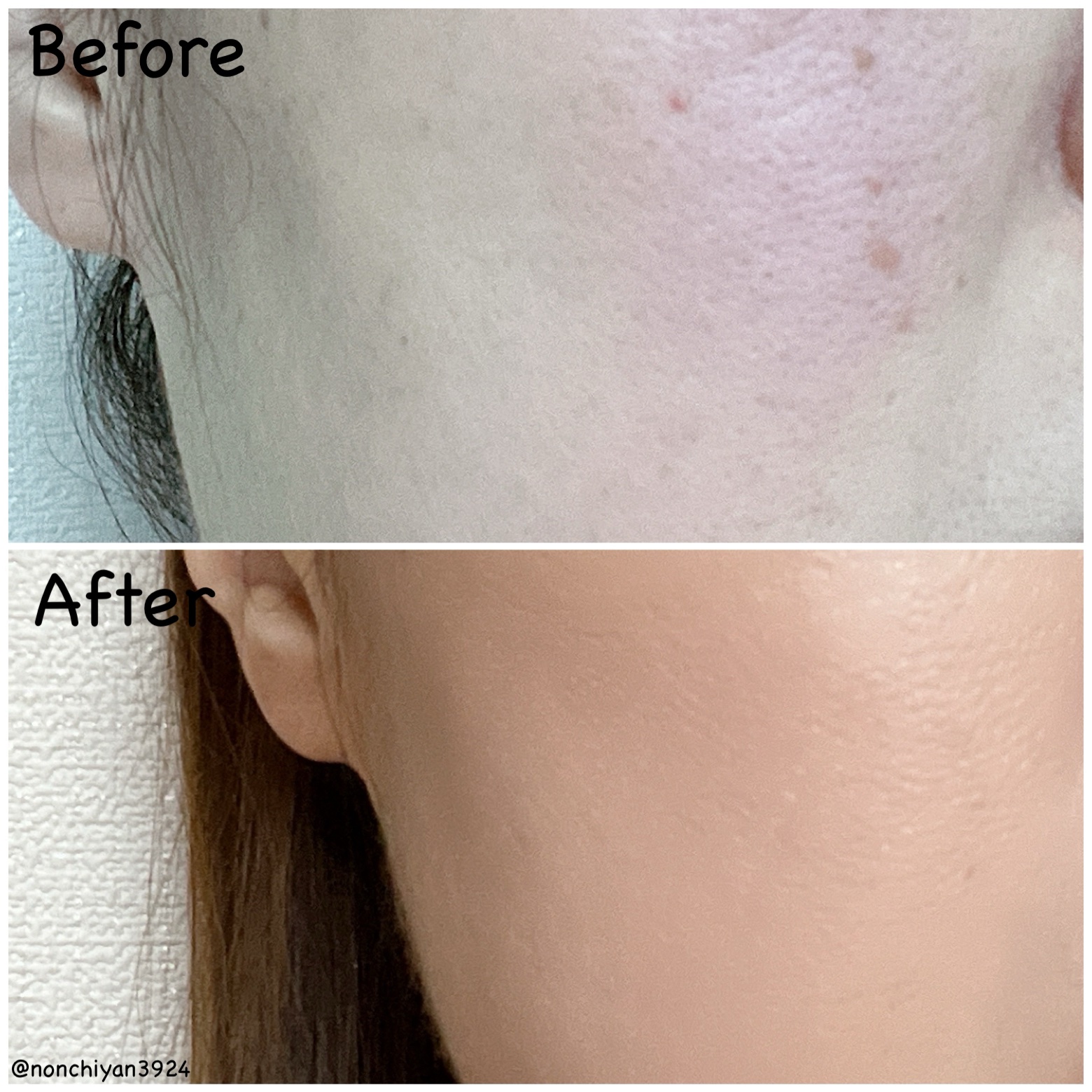 パーフェクティングフィッティング フルカバレッジクッション/LILIBETH/クッションファンデーションを使ったクチコミ（3枚目）