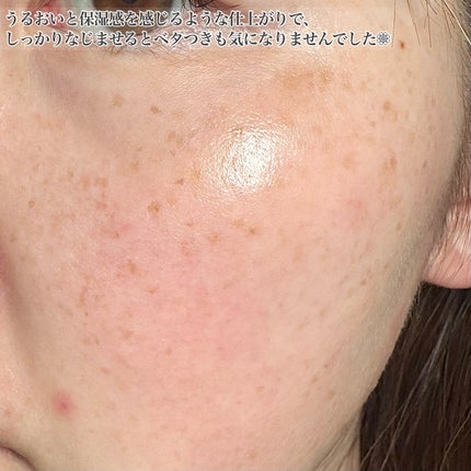 レッドブレミッシュ クールスージングマスク/Dr.G/シートマスク・パックを使ったクチコミ(7枚目)