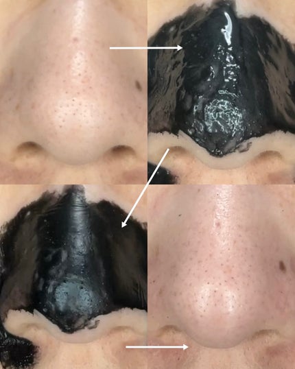 ツルリ ねっちり密着 スッキリはがすパック EX/ツルリ/シートマスク・パックを使ったクチコミ(4枚目)