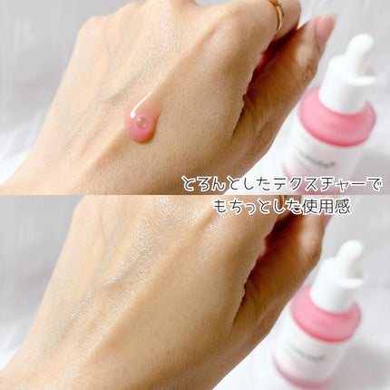 PDRNピンクアンプル PDRN 10,000ppm配合/MEDICUBE/美容液を使ったクチコミ(3枚目)