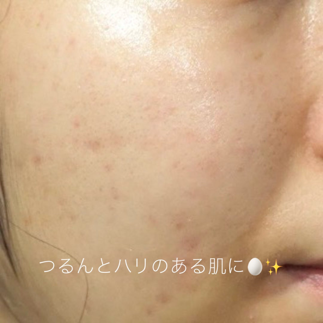 レチノール0.3 ナイアシンリニューイングセラム/Anua/美容液を使ったクチコミ(3枚目)