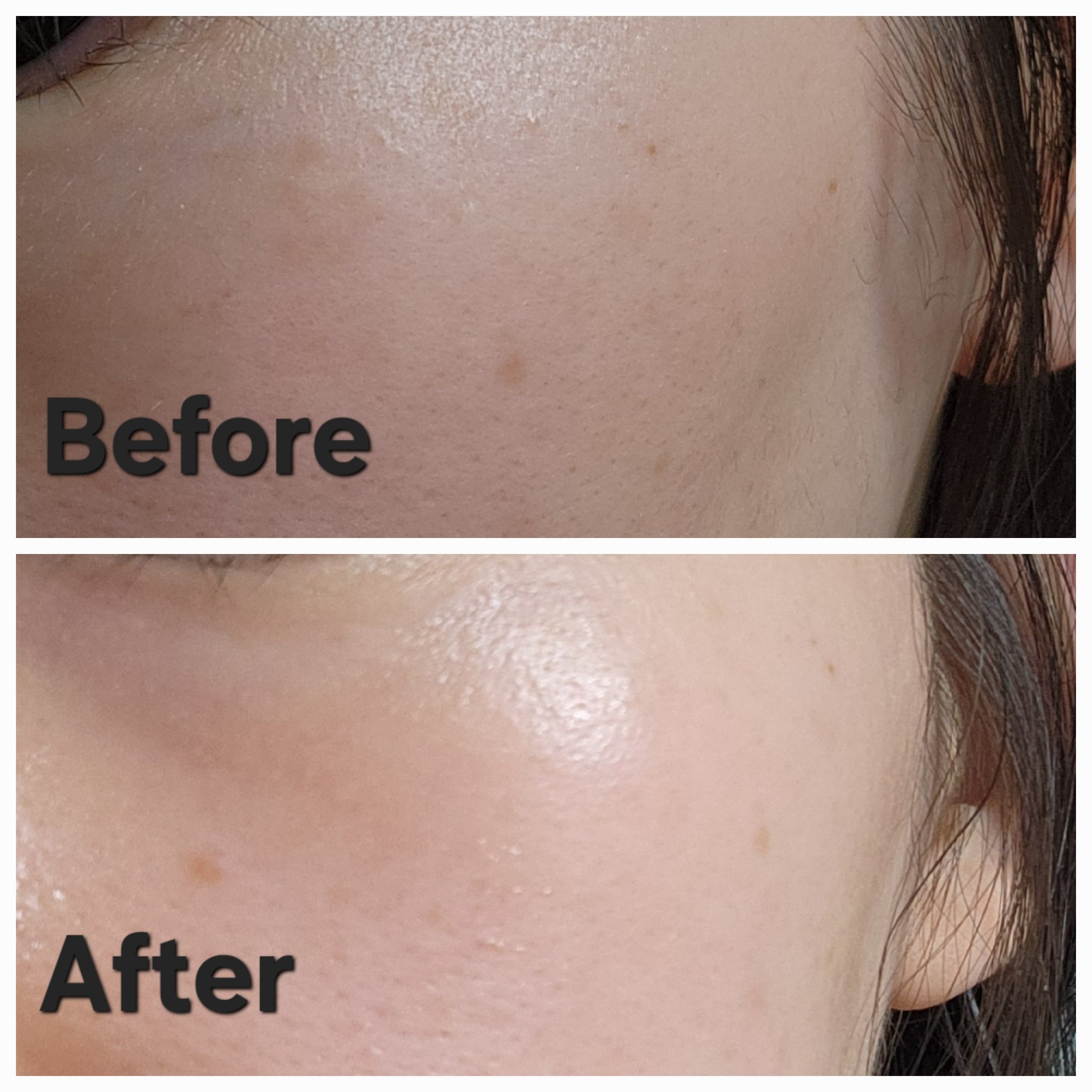 グルタチオンショットB3シミ跡セラム/It's skin/美容液を使ったクチコミ（3枚目）