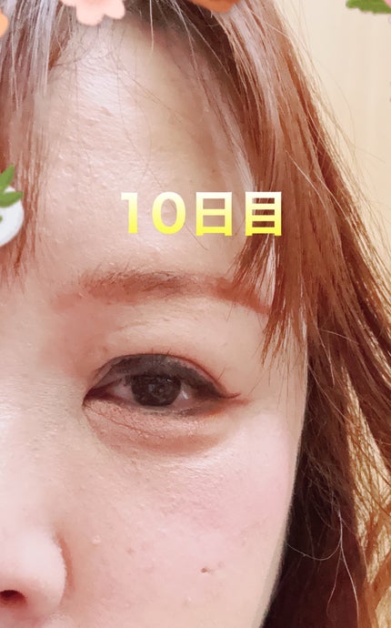 を使ったクチコミ(1枚目)