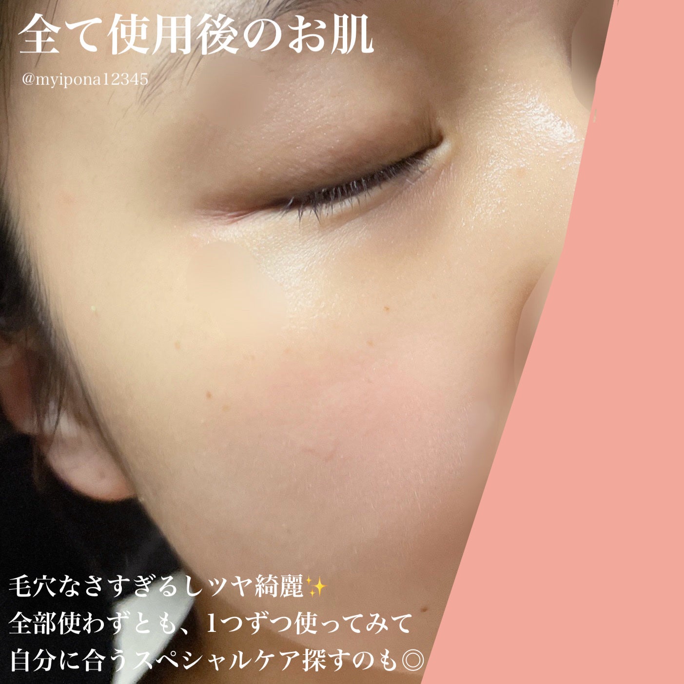 モデリングパックグロウプロジェクト/choRIN/シートマスク・パックを使ったクチコミ(6枚目)