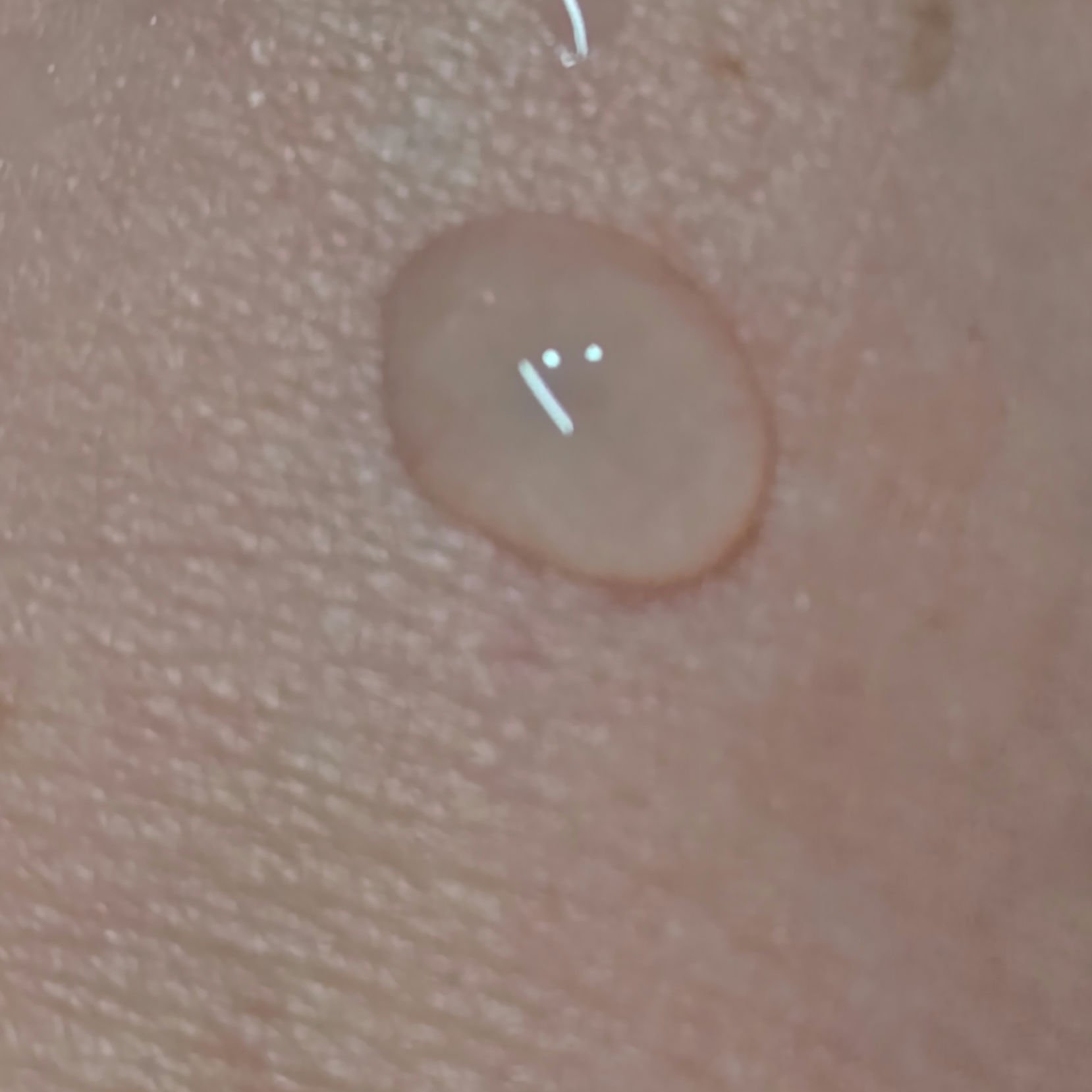 アイゾーンブースター/リバイタル/アイケア・アイクリームを使ったクチコミ（3枚目）