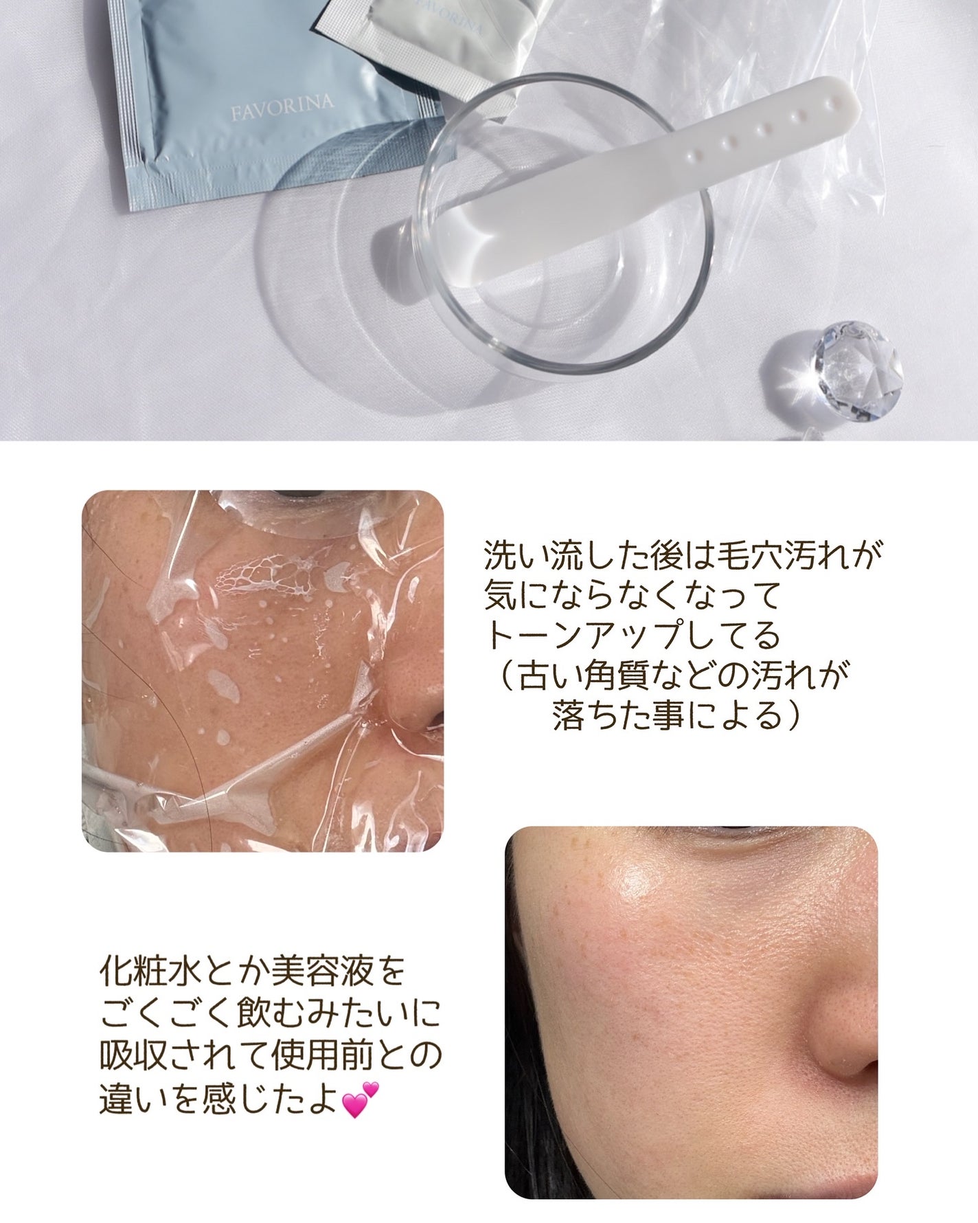 炭酸ジェルパック/NANO ACQUA/洗い流すパック・マスクを使ったクチコミ(5枚目)