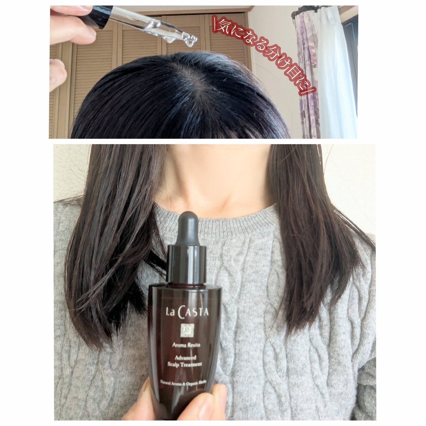 アロマ リヴァイタ アドバンスト スキャルプトリートメント/ラ・カスタ/頭皮ケアを使ったクチコミ(4枚目)