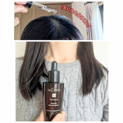 アロマ リヴァイタ アドバンスト スキャルプトリートメント/ラ・カスタ/頭皮ケアを使ったクチコミ(4枚目)