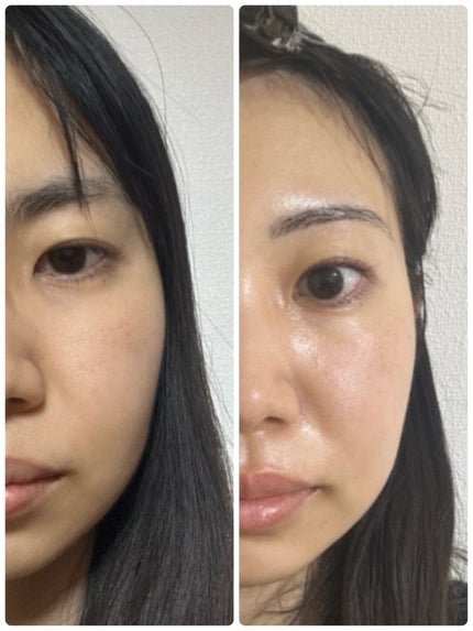 ageLOCブースト/ageLOC/美顔器・マッサージを使ったクチコミ(2枚目)