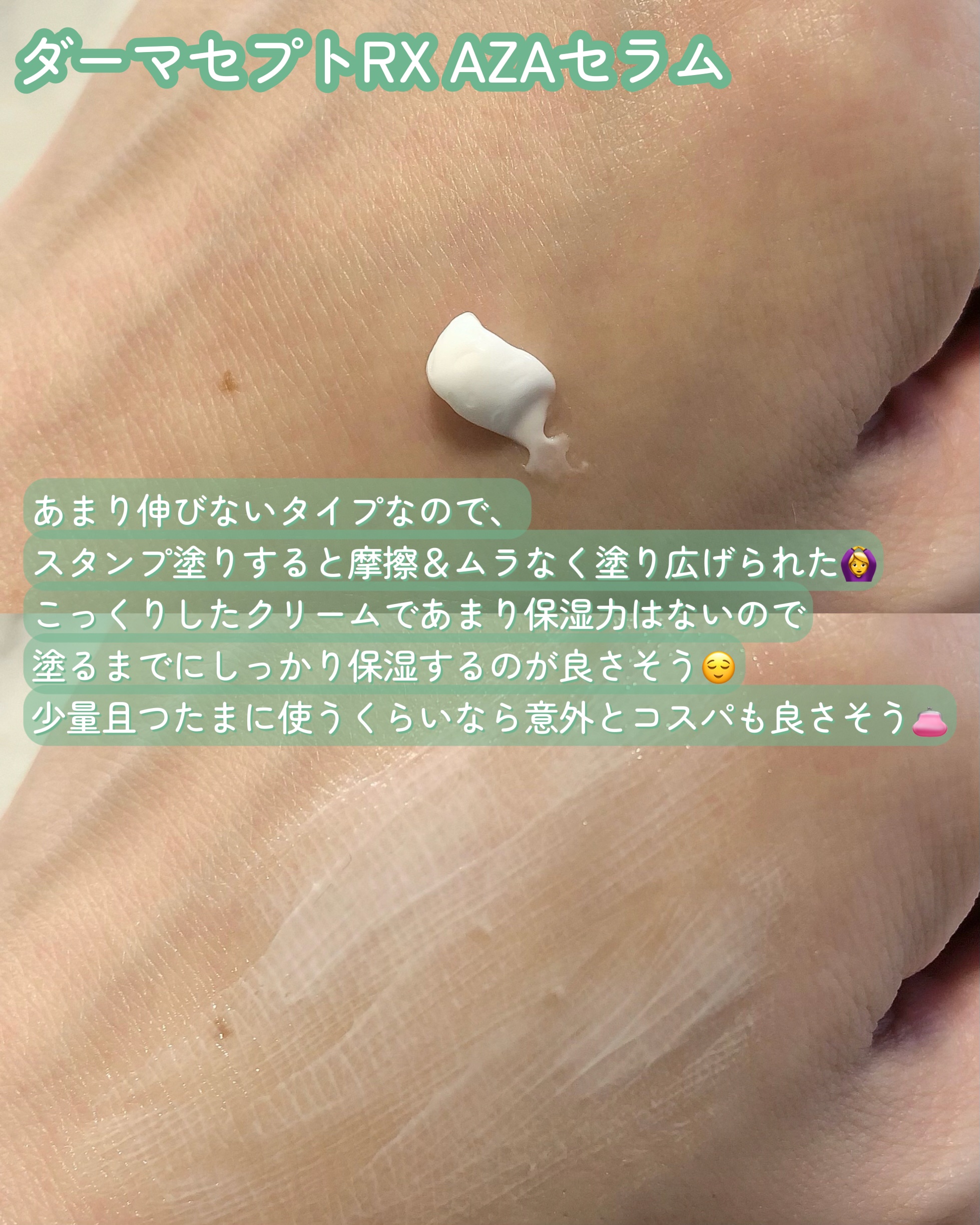 ダーマセプトRX　AZAセラム/ダーマセプトRX/美容液を使ったクチコミ（3枚目）