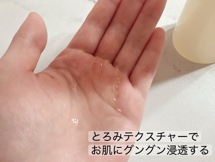 オバジC クリアアドバンスドローション/オバジ/化粧水を使ったクチコミ(2枚目)