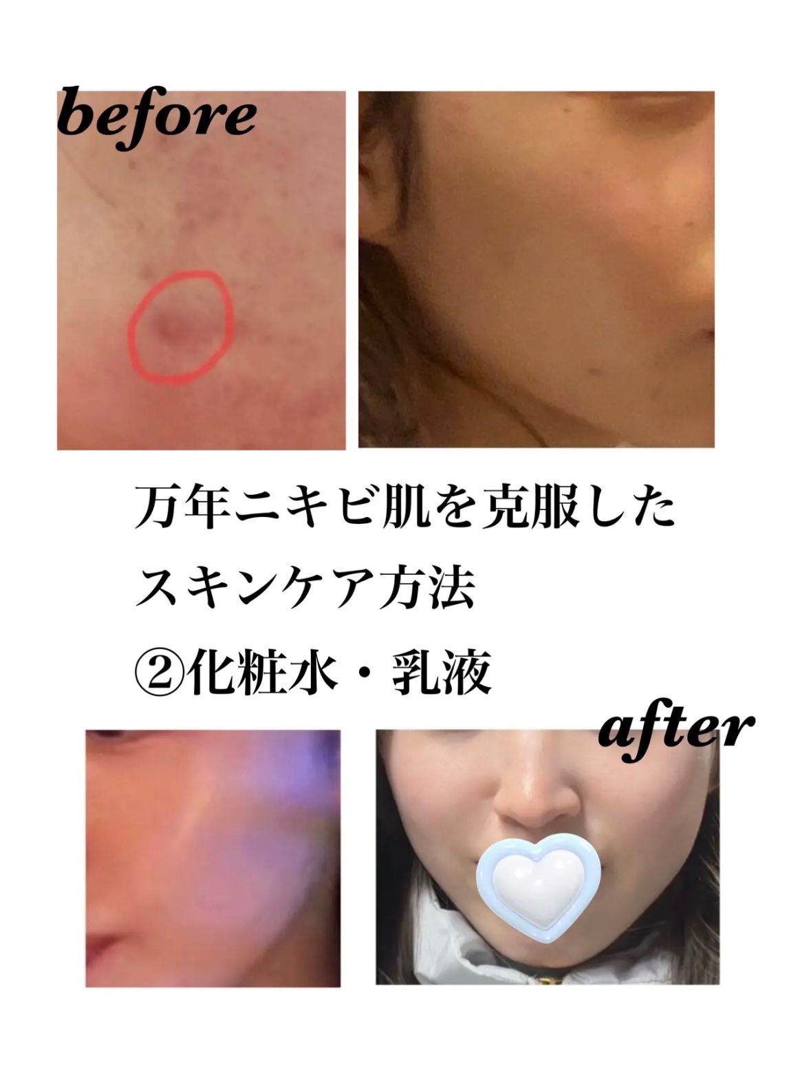 リペア薬用保湿化粧水 とてもしっとり/コラージュ/化粧水を使ったクチコミ（1枚目）