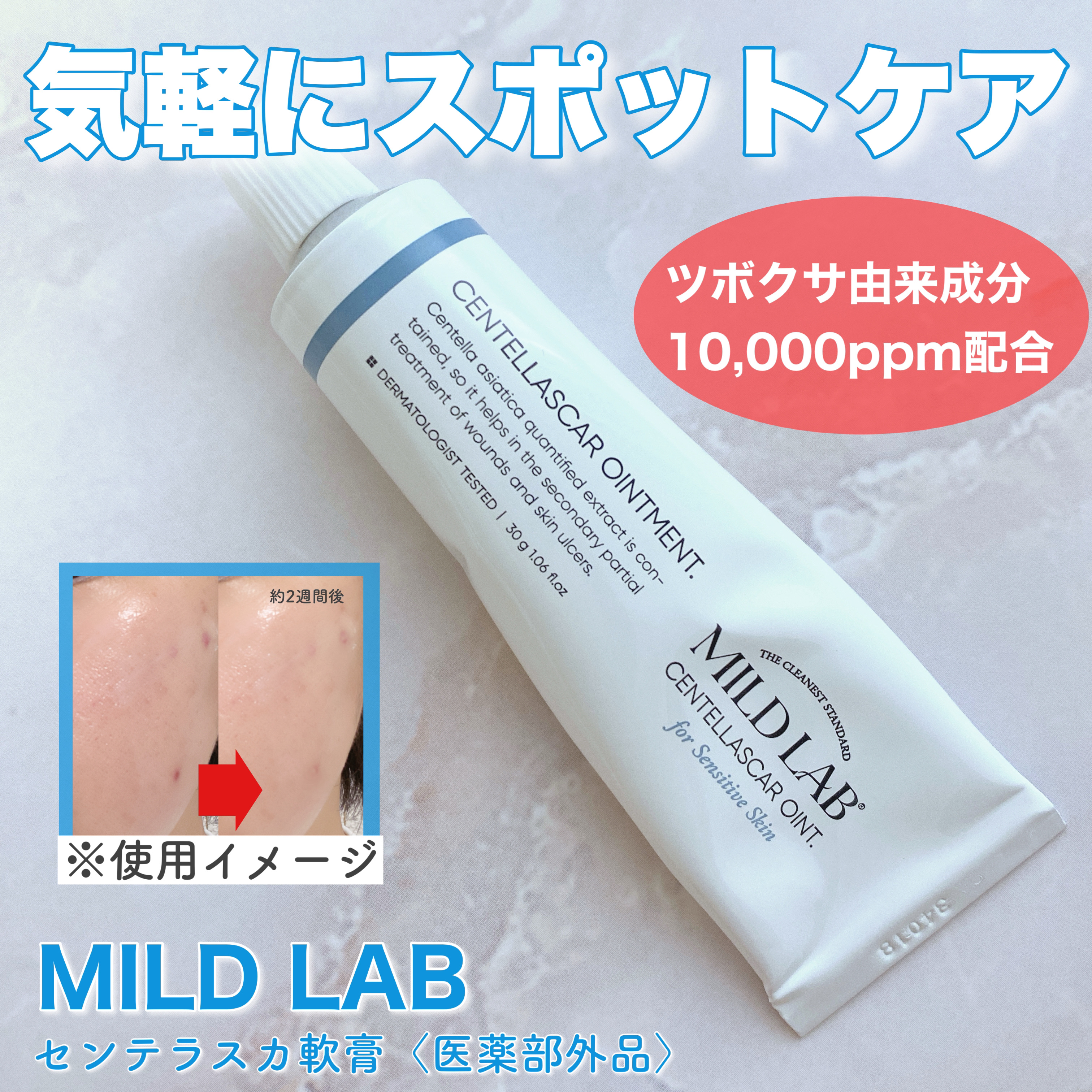 センテラスカー 軟膏 (オイントメント)/Mildlab/フェイスクリームを使ったクチコミ（1枚目）