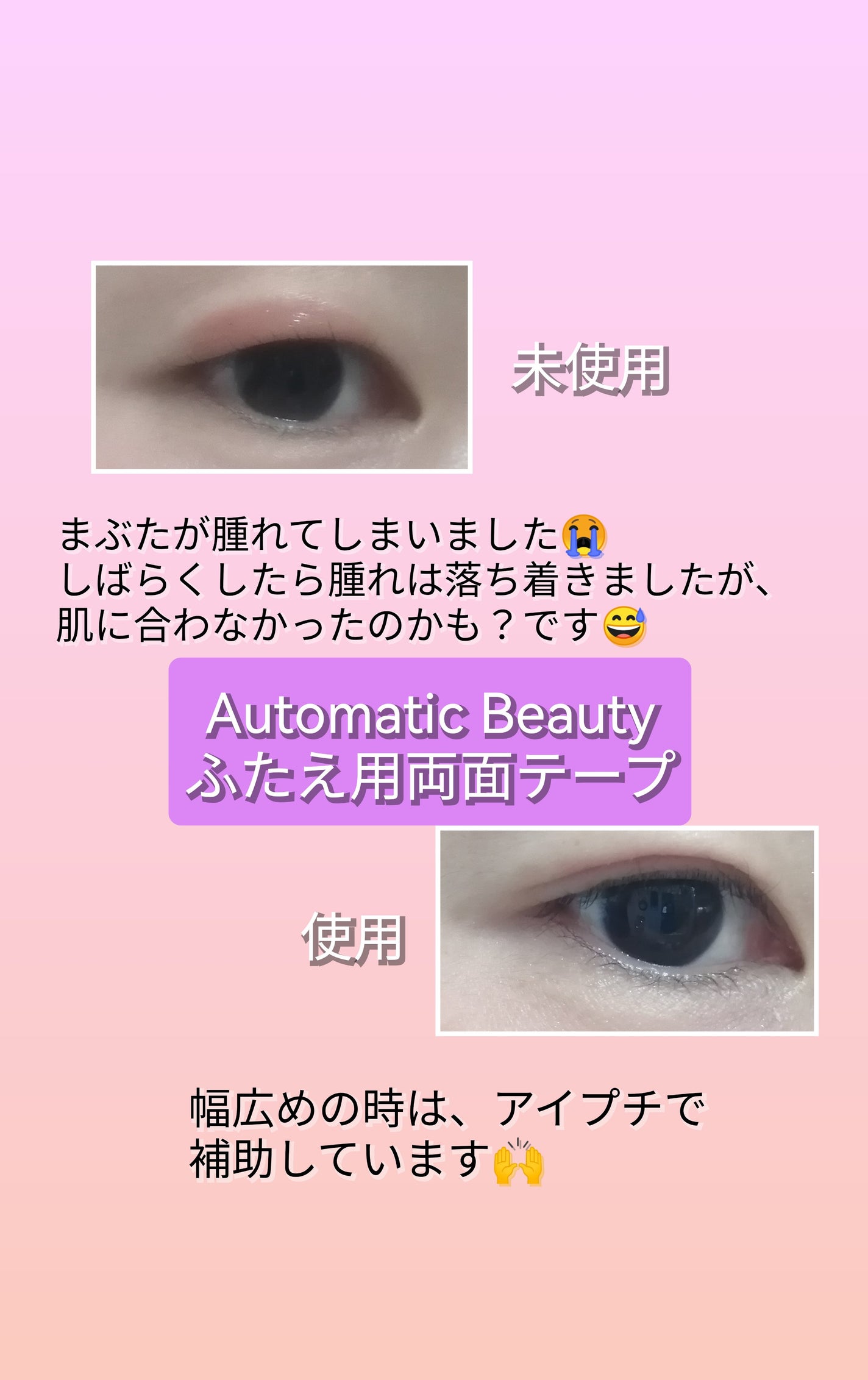 ふたえ用両面テープ/Automatic Beauty/二重まぶた用アイテムを使ったクチコミ(6枚目)