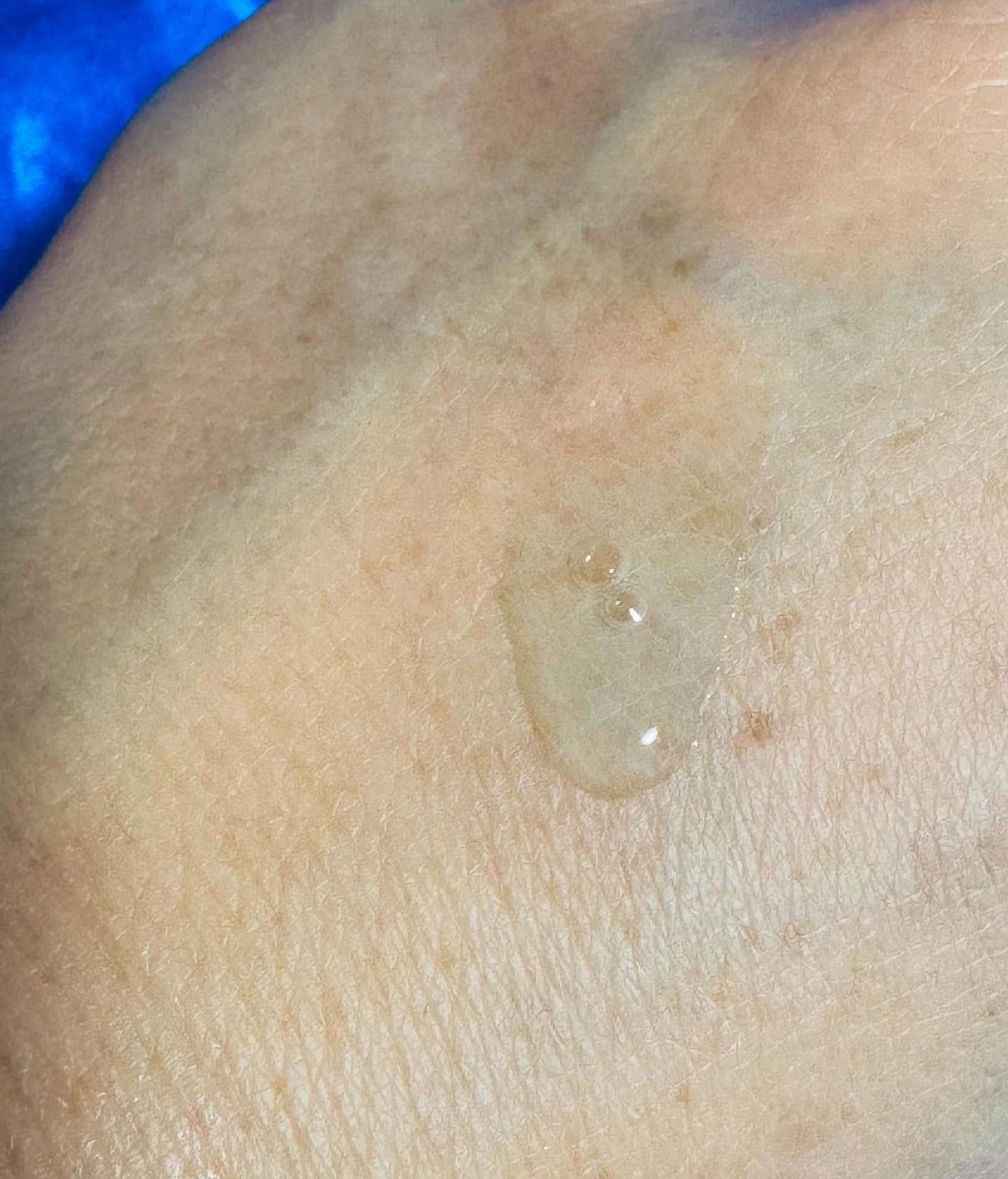 クラウドアンプル 1week キット/CHARDE/美容液を使ったクチコミ(5枚目)