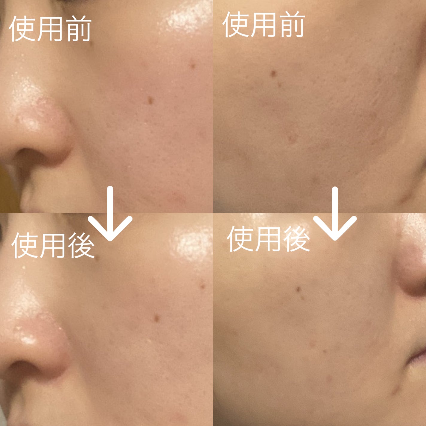 アディクション シルキーバームプライマー/ADDICTION/化粧下地を使ったクチコミ(3枚目)