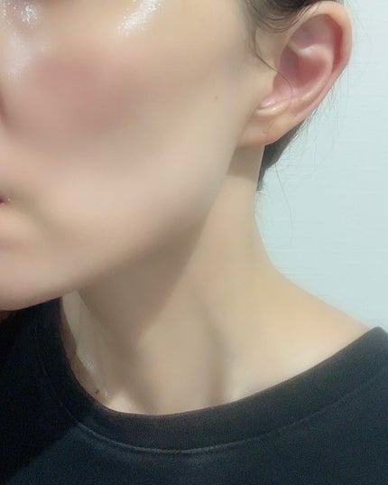 ビタトーニングセラムトナー/ダルバ/化粧水を使ったクチコミ(6枚目)