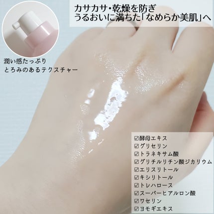 モイストケア ローション MB/d プログラム/化粧水を使ったクチコミ(2枚目)