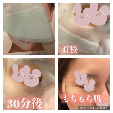 パーフェクト リアル パフォーマンス ヒアルコラーゲ ンマスクパック /ダーマフィックス/シートマスク・パックを使ったクチコミ(2枚目)